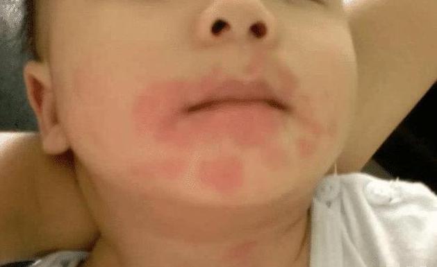 四种水果不适合1岁宝宝吃,这4种水果不能让孩子碰