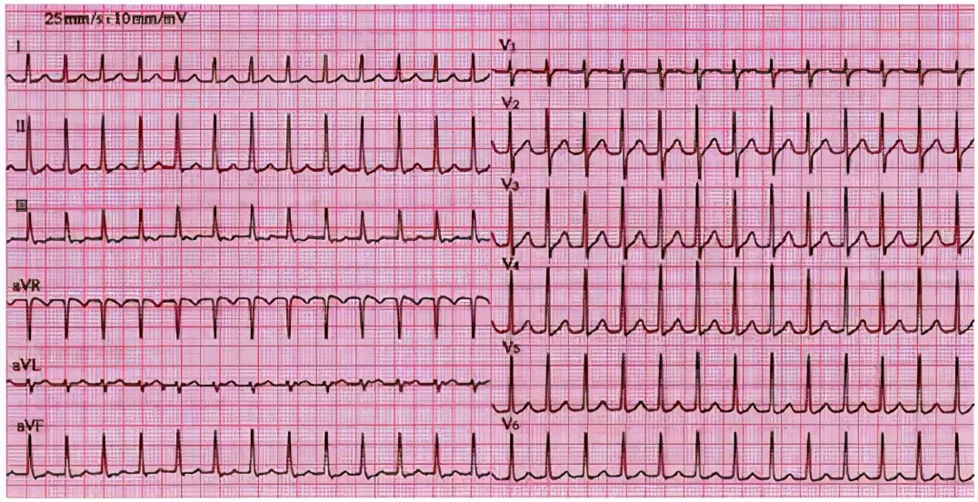 检查心脏心电图,检查心脏彩超是最好的吗