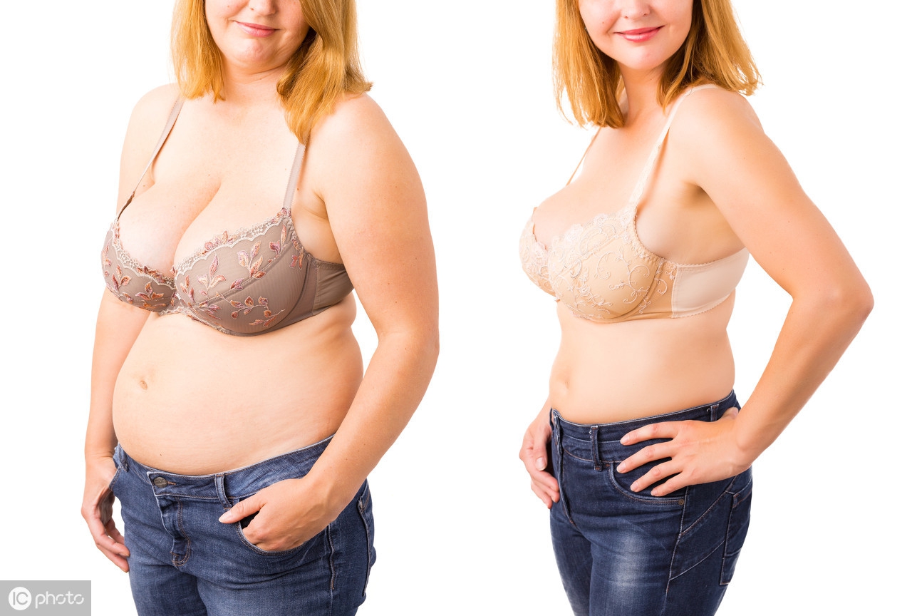 怀孕多囊减肥成功案例,多囊卵巢减肥怀孕