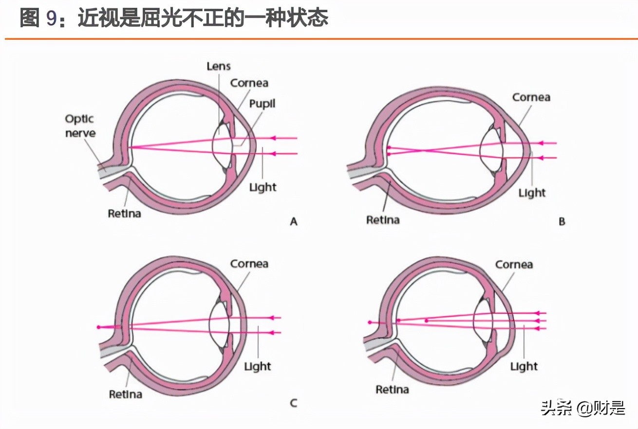 爱博医疗研报,爱博医疗最新资讯