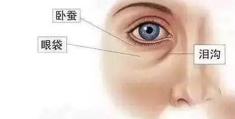 眼袋显老10岁三种方法帮助改善,眼袋显老怎么解决