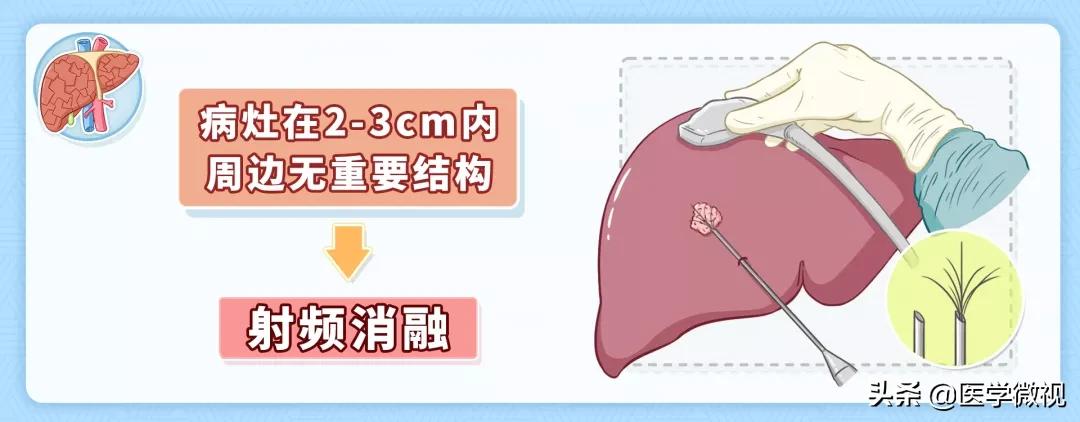 专家讲座怎么保肝护肝,专家讲护肝方法