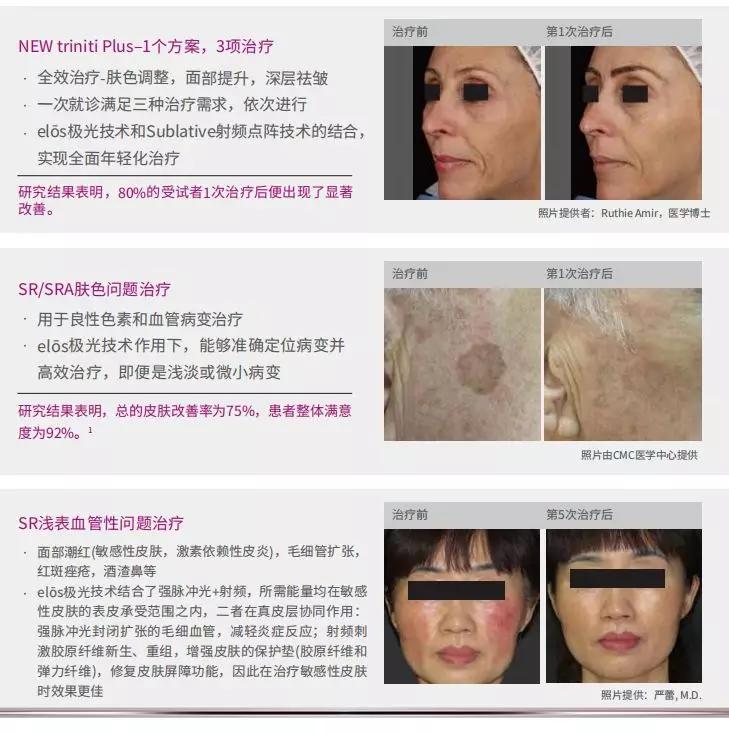 elōsPlus光电传奇，集祛斑除皱紧肤提升于一体