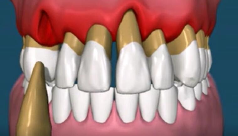 狗狗洗牙的良心忠告,医生忠告千万别洗牙