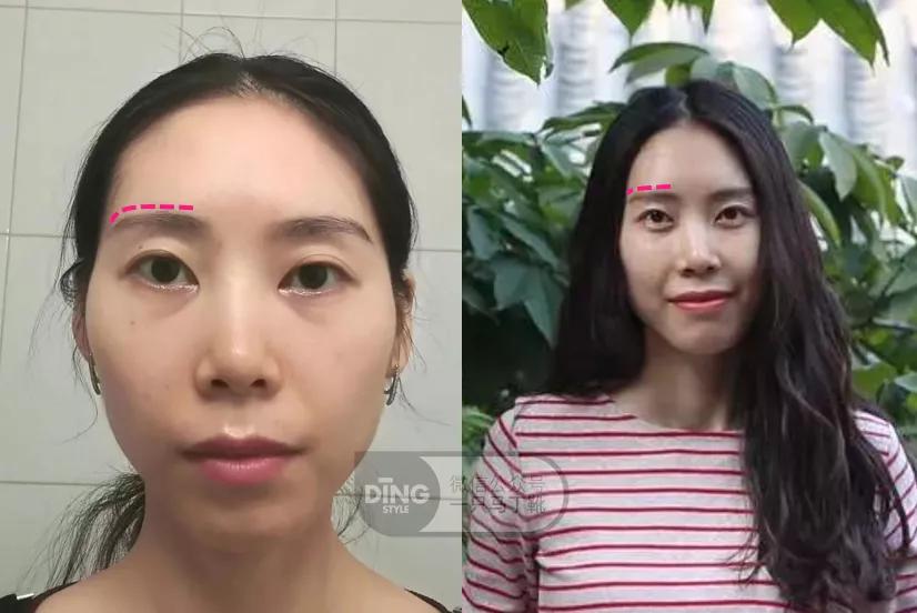 圆胸要怎样改善,小胸平胸选什么样的罩杯显大