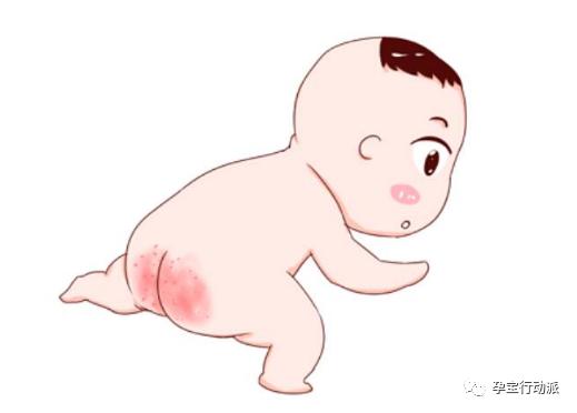 宝宝红pp是什么原因,宝宝红pp什么原因