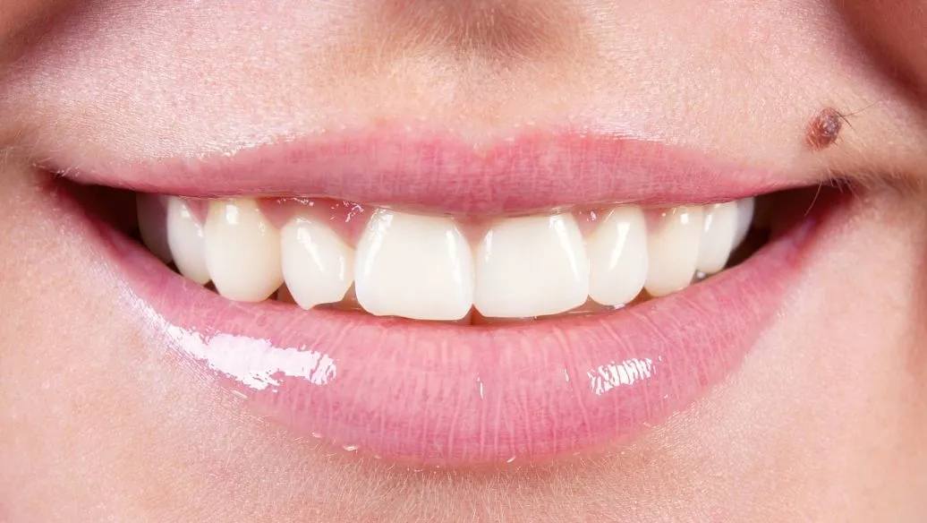 牙齿断裂会导致什么危害？该怎么解决？