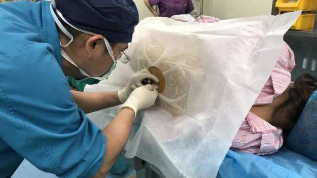 生孩子是在后背哪里打的麻药,生娃后背打麻药