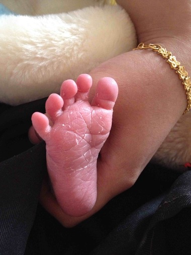 宝宝体重太轻怎么办,宝宝体重减轻不长肉