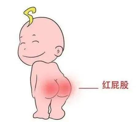 正确处理尿布疹的方法,尿布疹如何预防和处理