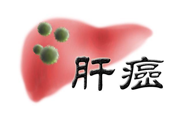 肝癌1b期手术切除后会复发吗,高分化肝癌切除彻底还会复发吗