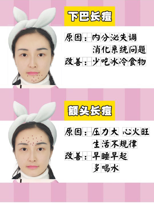 脸上各个位置长痘痘的原因是什么,脸上痘痘的种类及图片