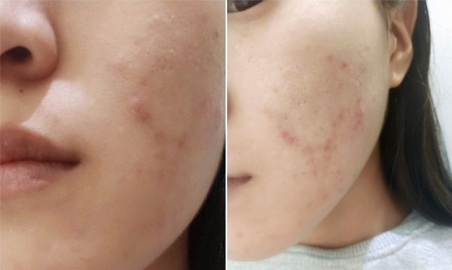 蒂佳婷新款银管bb霜,蒂佳婷遮瑕银管bb霜