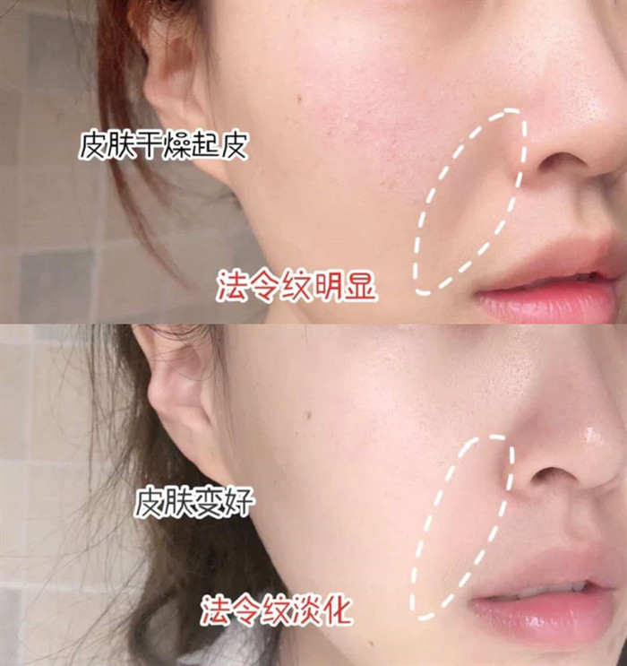 女子为变美花掉300余万后续,女子为变美脸塌陷