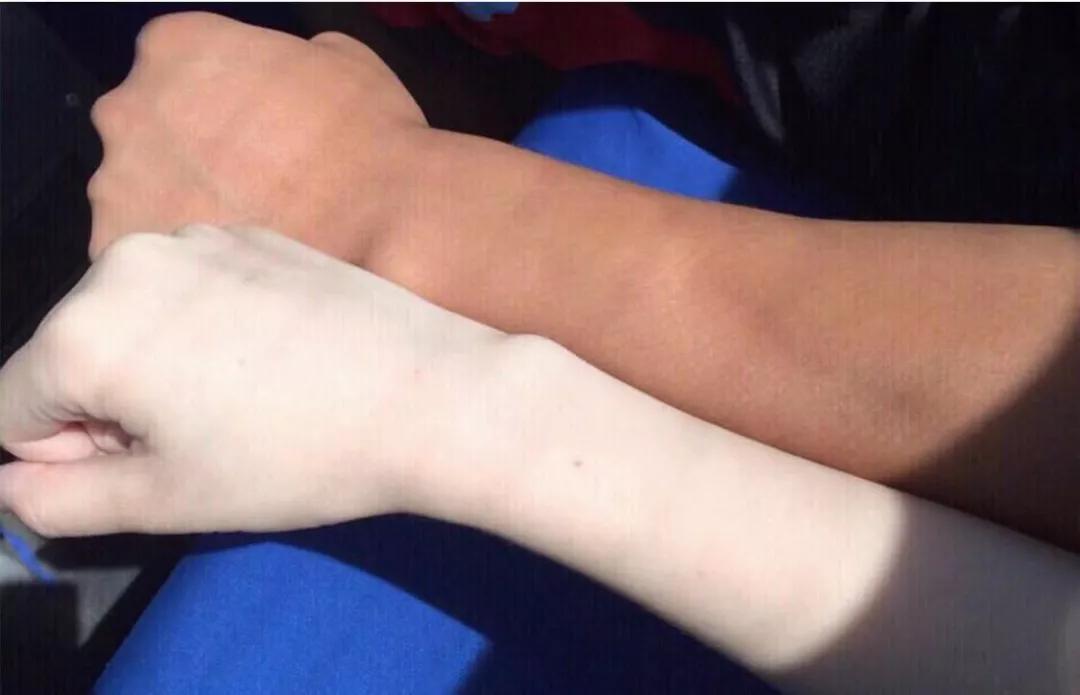 平价淡斑美白小灯泡,神仙水小灯泡精华淡斑