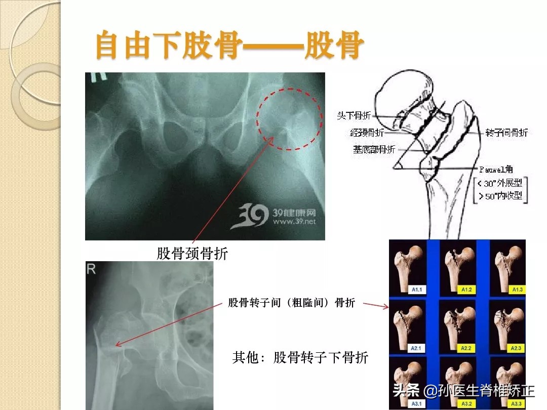 人体解剖学骨骼学思维导图,人体骨骼解剖学纪录片