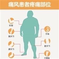 乌鸡白凤丸痛风该怎么服用,乌鸡白凤丸治疗痛风患者有效果吗