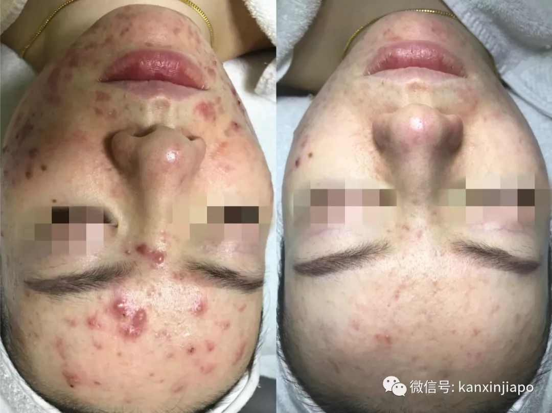 每周一次精准有效的皮肤管理,选对护肤方法让你做靓丽女神