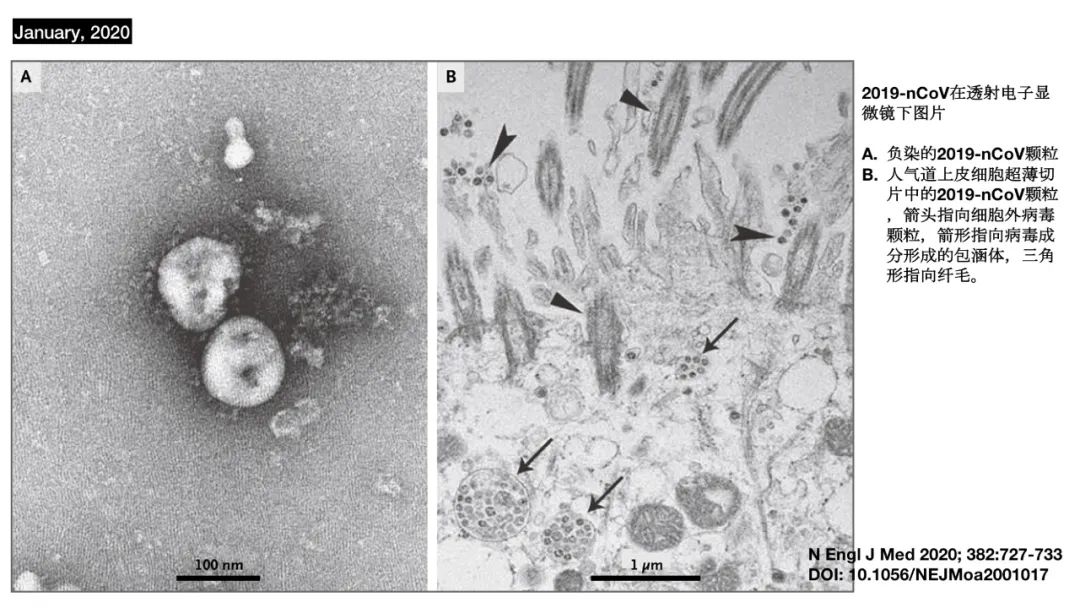 新冠病毒检测结果实验室解读,新冠病毒有哪些实验室检测方法