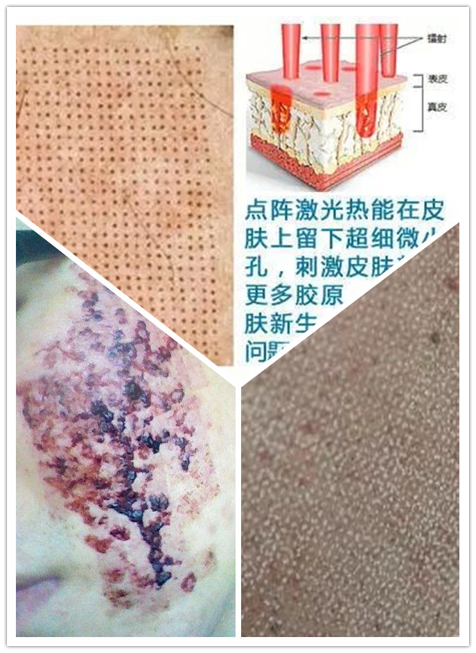 都挺好评分高还是低,都挺好后期