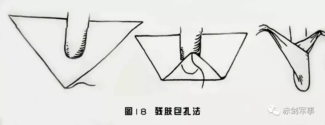 军队三角巾包扎法视频,部队卫生与救护三角巾包扎方法