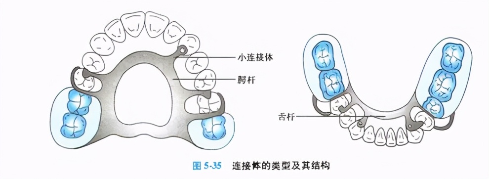 牙列缺损的可摘局部义齿修复题库,牙科美学修复精讲