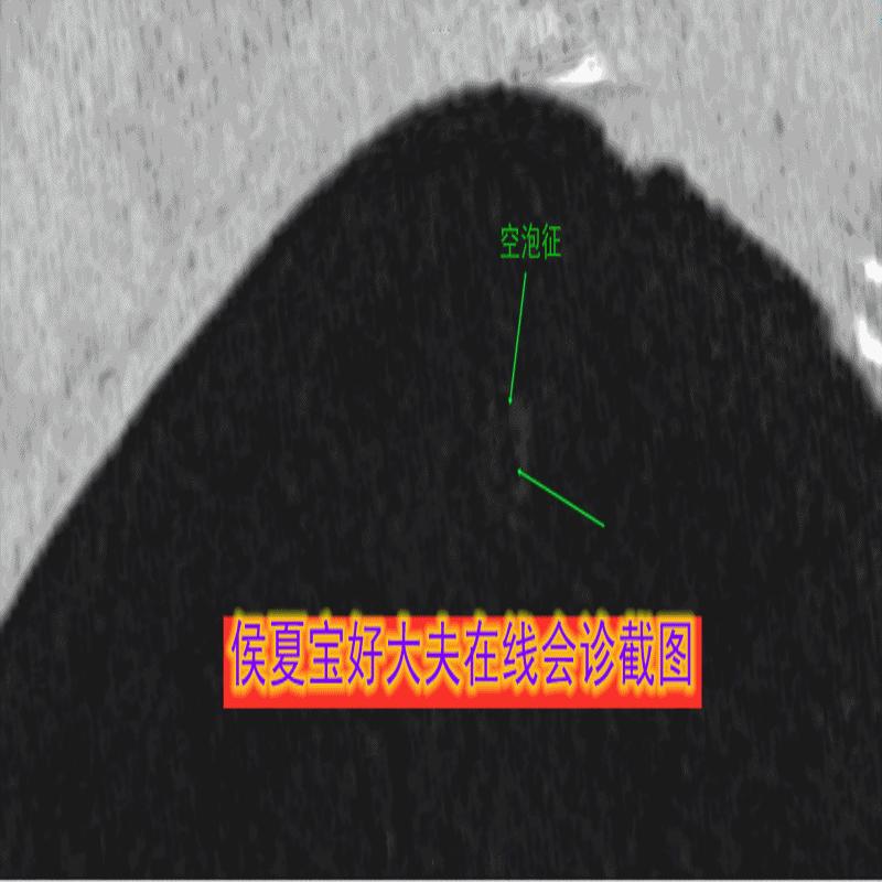 细思极恐的海啸,细思极恐癌症