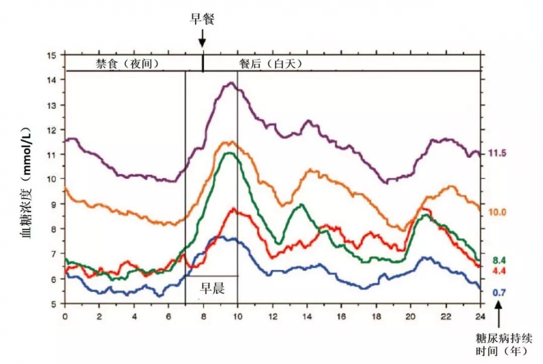 空腹血糖多高属黎明现象,空腹血糖高靠控制饮食能降下来吗