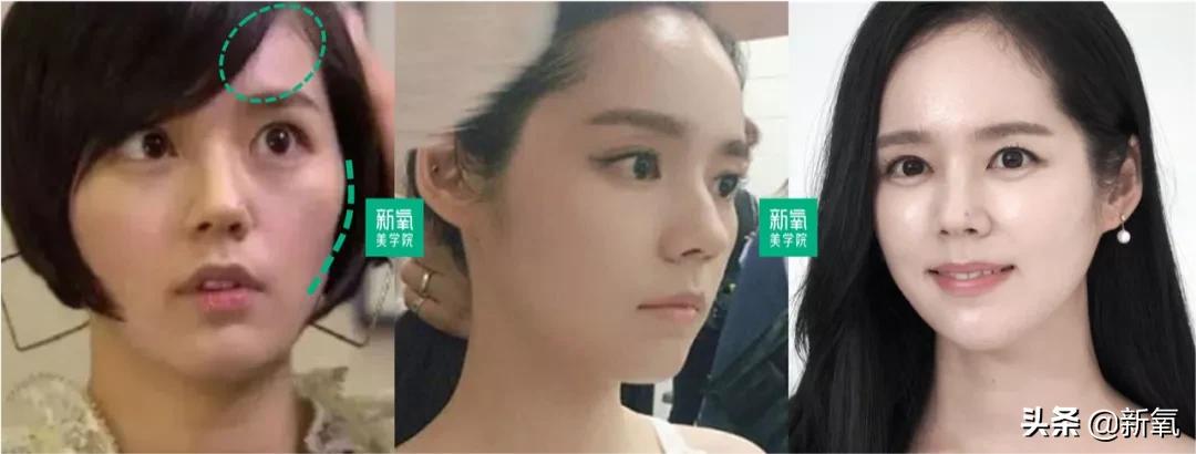 如何用点线面构建空间层次感,面型改善