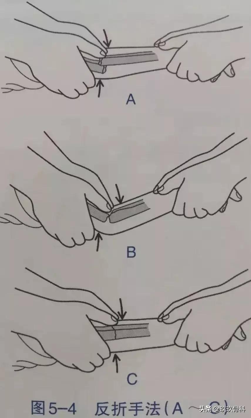 骨折手法整复术多少钱,骨折恢复手法视频教程