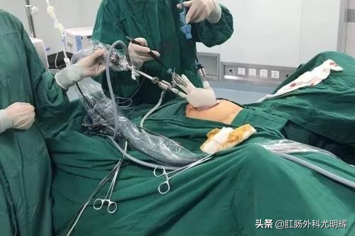 肠道不蠕动需要切除吗,结肠疾病要怎么治疗