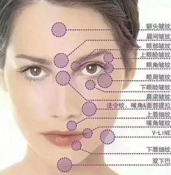 面部衰老除了线雕还可以做什么,线雕提升抗衰老