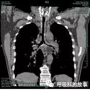 平台型的变化是什么,平台功能有什么新的变化