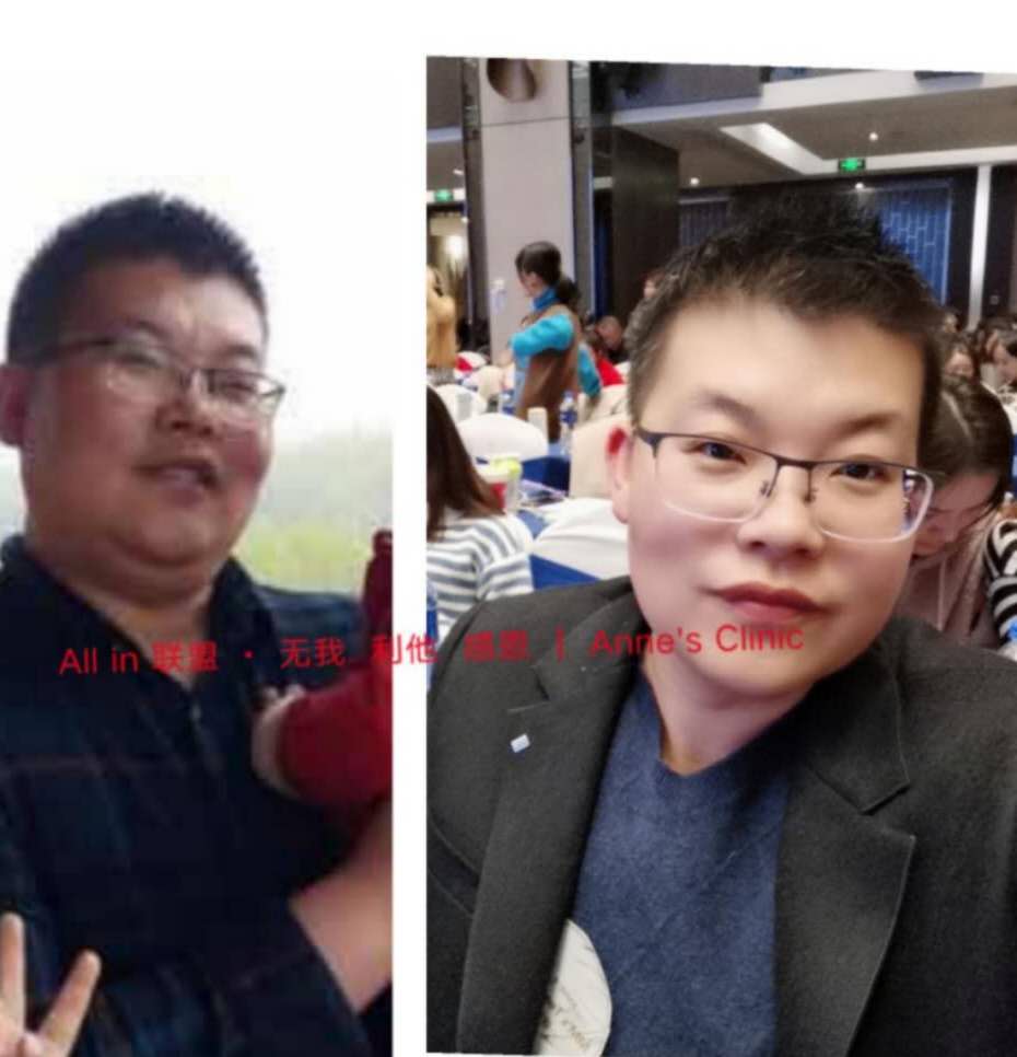 用过十几种减肥方法最终被安馨3021干掉60斤肥肉