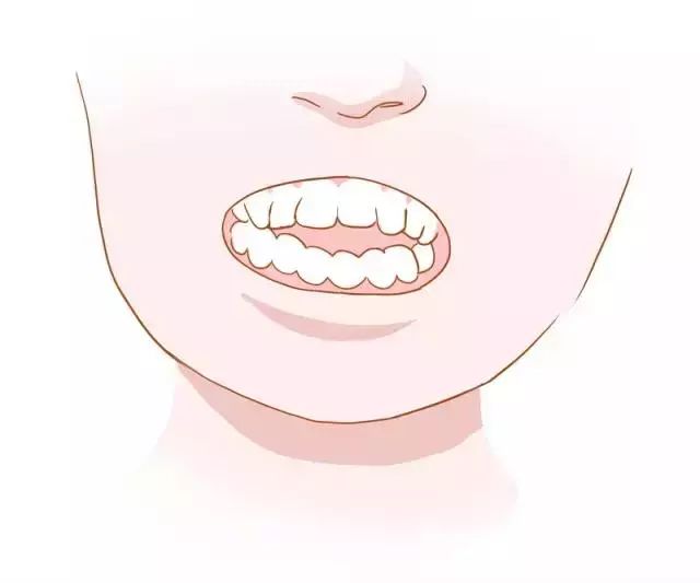 牙齿矫正全过程看完你就知道,目前几种常见的牙齿矫正方式