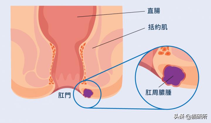 猫咪会长毛囊炎吗,猫咪会长老年斑吗