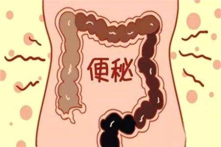 便秘都是上火吗?教你正确使用通便的中成药!