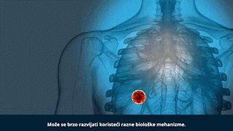 注射治愈癌症,肺癌晚期用什么针药能减轻痛苦