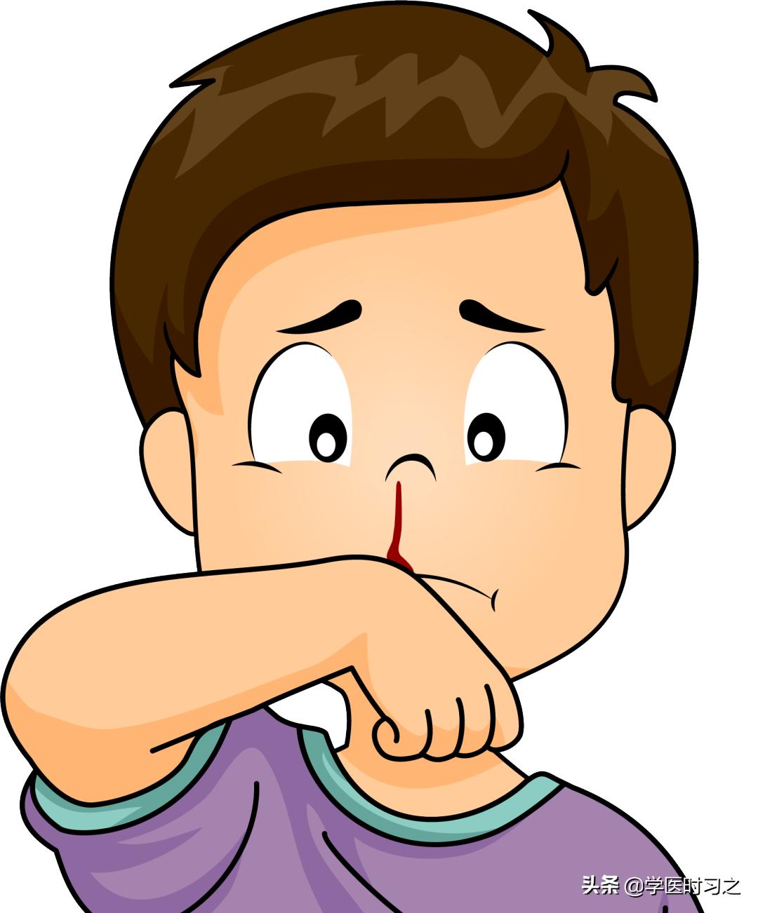 怎么治鼻出血的秘方,秋季小儿鼻出血的防治转载