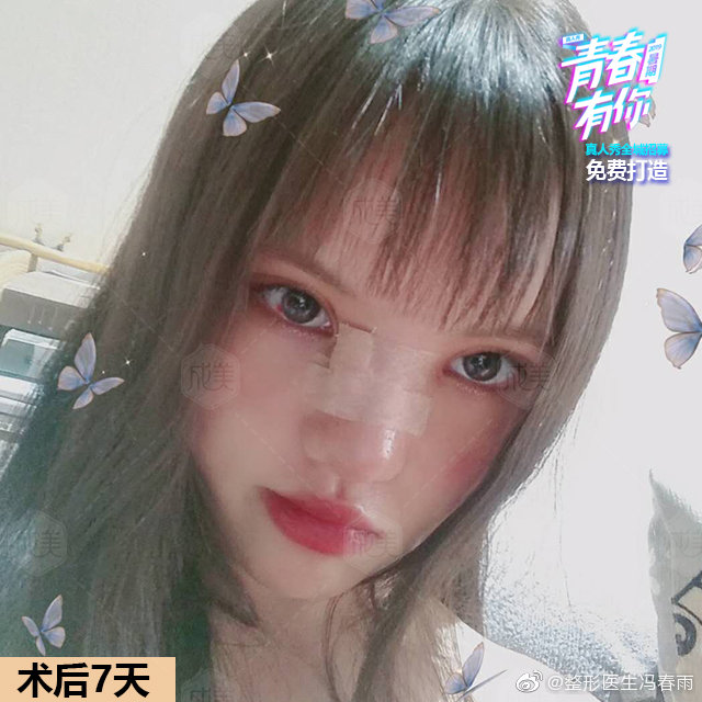 双眼皮做完有肉条怎么办,做完双眼皮肉条很难看