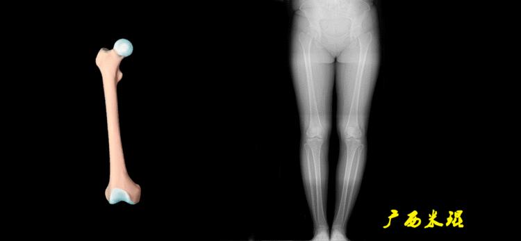 广西骨科医生米琨最新信息,米琨广西骨科什么水平