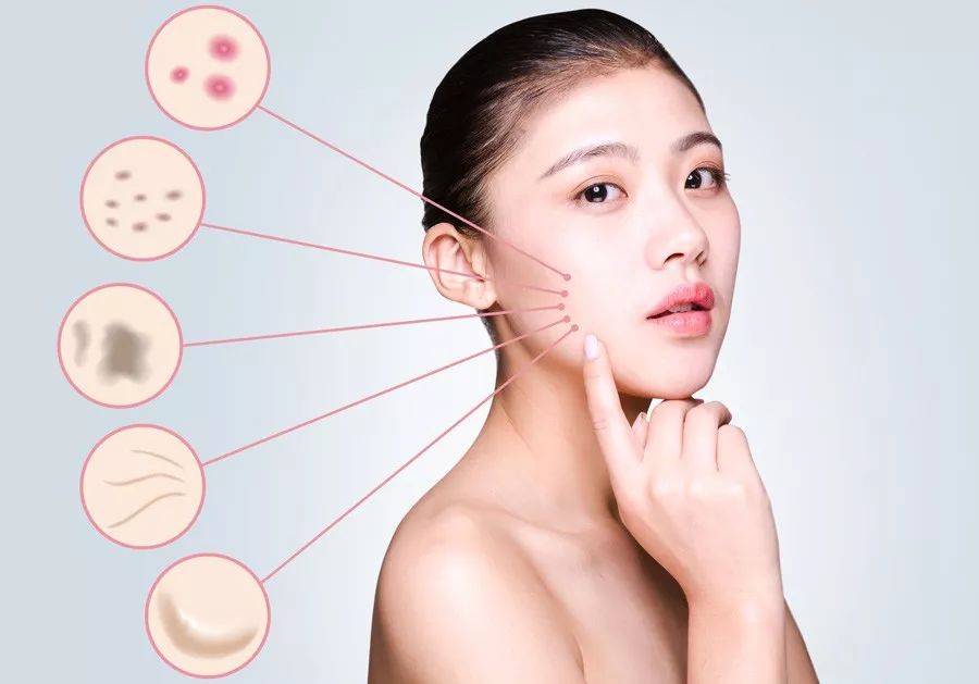 果酸换肤治疗色斑效果,淡化脸上的斑点果酸换肤