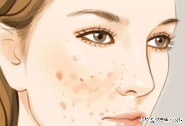 去脸上的斑斑点点怎么做,吃什么消除脸上斑斑点点