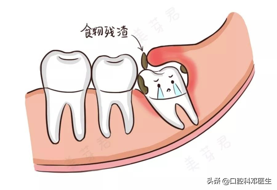 疫情后牙齿怎么修复好一点,新冠肺炎有牙齿方面的症状吗