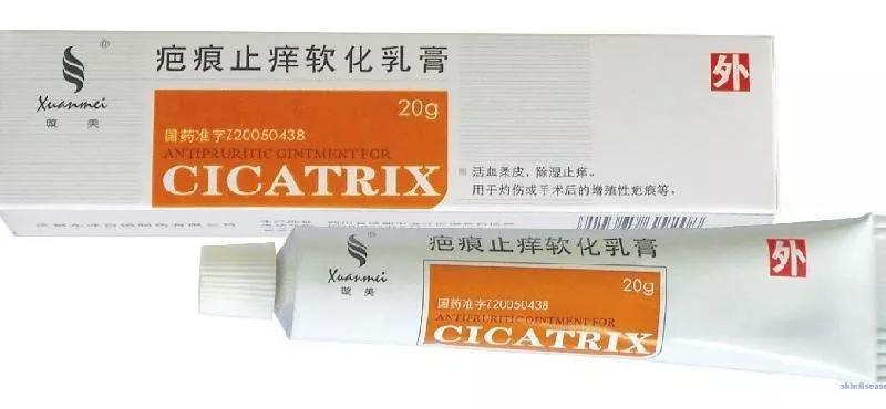 剖腹产的疤痕增生怎么除疤,疤痕体质如何才能正确除疤