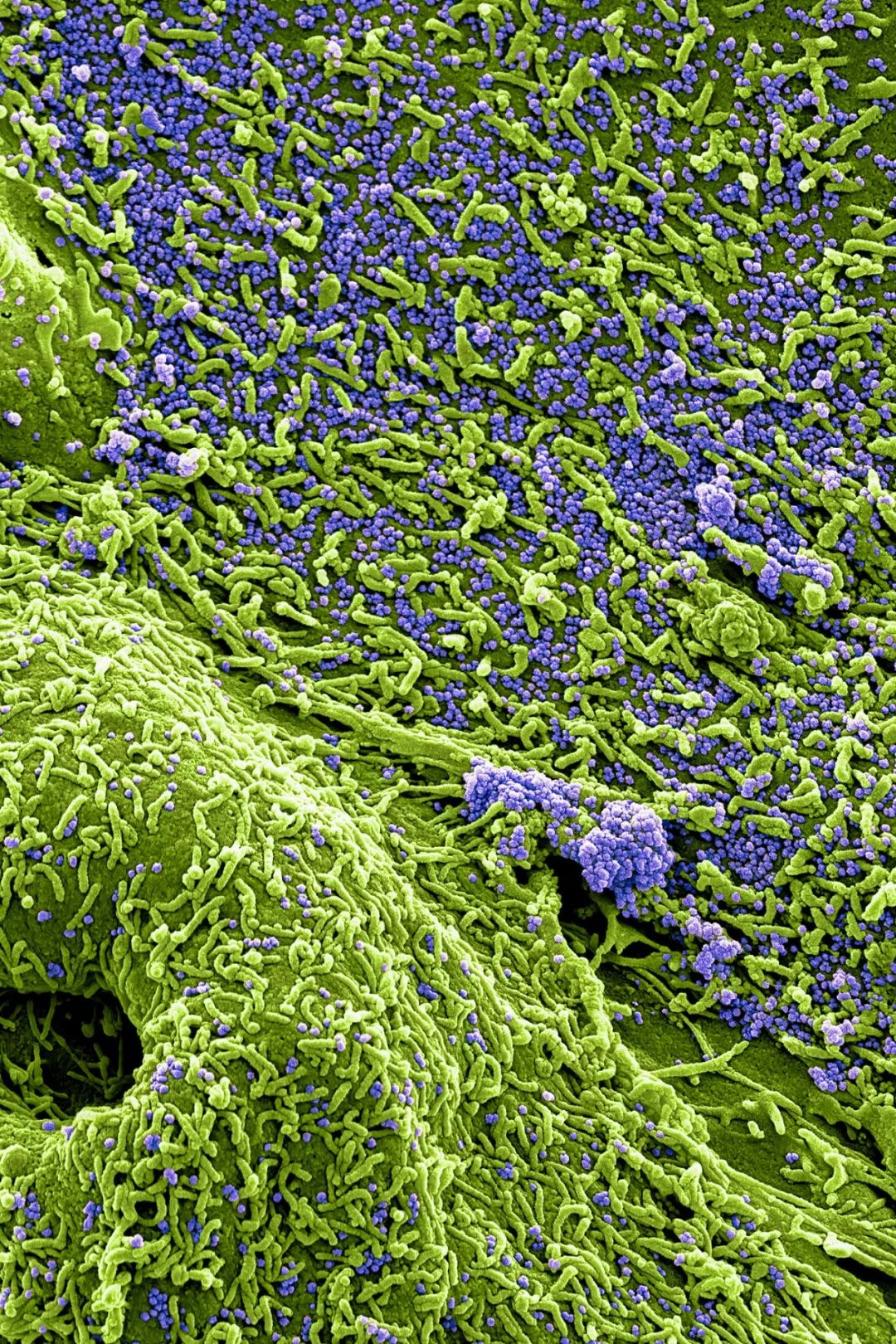 人体防卫战,人体痛点攻击技巧