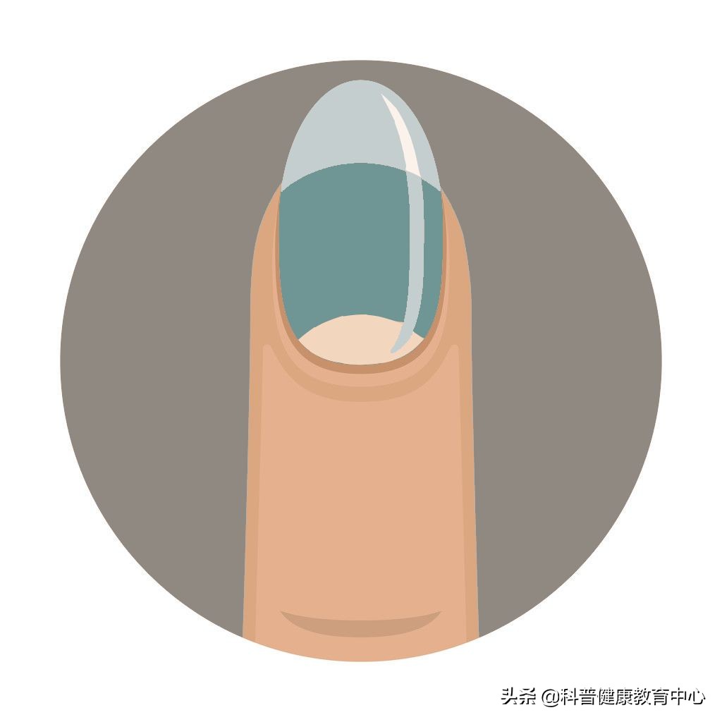 手相的科学解释,从医学角度解读手相的秘密