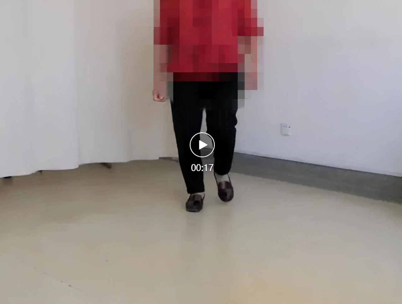 股骨和胫骨双部位截骨拯救复杂膝关节内翻畸形