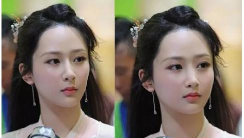 小杰老师：法令纹是如何产生的？如何消除？