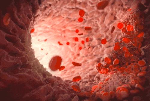 身上出现淤青如何解决,身体淤青千万不要大意